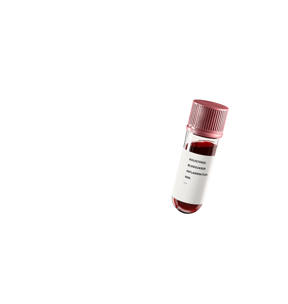 Prøveglas mærket kolesterol, blodsukker og inflammation