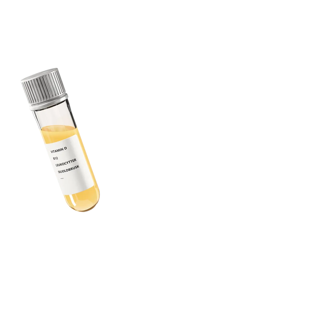 Prøveglas med serum, mærket vitamin D, B12, leukocytter og skjoldbrusk